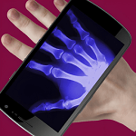 ģ��X�����ֻ���v1.1.2 ��׿��