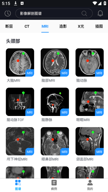 Ӱͼapp