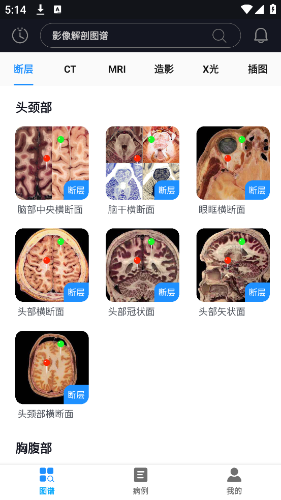 Ӱͼappv4.3.1 ٷ
