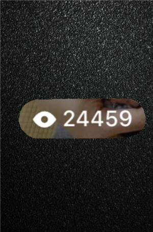 С����С�۾����Ķ������ع� С����С�۾�1000�㲻���