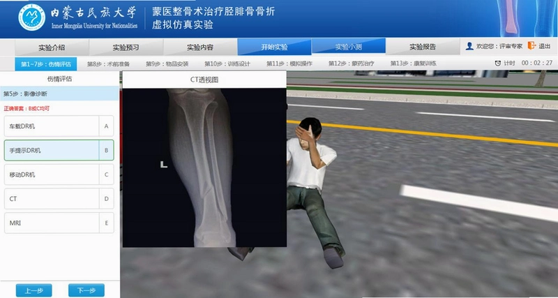 Osteotic Bypass ������·1.0 Ӳ�̰�