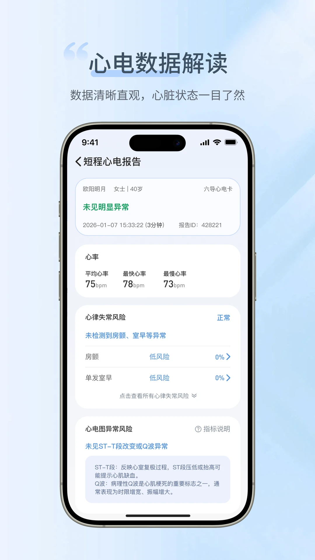 卡帕奇心电appv1.1.1.2 安卓版