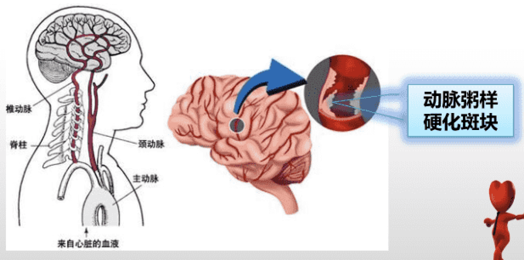 脑羽是什么梗 脑羽含义出处科普配图