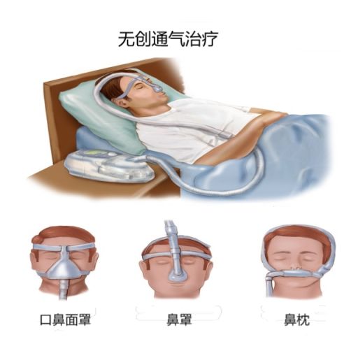 VHealth呼吸机助手使用教程与选购指南 连接设备查看睡眠报告