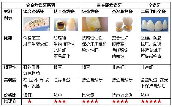 牙管家(技)牙齿修复方案选择对比图 烤瓷牙全瓷牙种植牙活动假牙区别